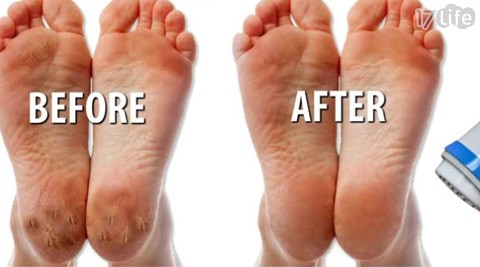 COCOGO-TV热卖新款双头电动磨脚皮器-还你天使也忌妒的BABY FOOT!电动磨脚皮无痛、不伤皮肤,轻轻滑过,脚ㄚㄚ就光滑柔嫩!