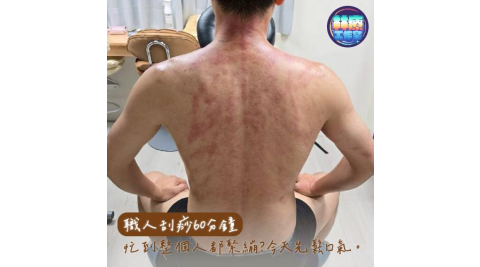 新竹【林療工作室】職人刮痧推薦｜精準鬆解緊繃60分鐘 (MO)