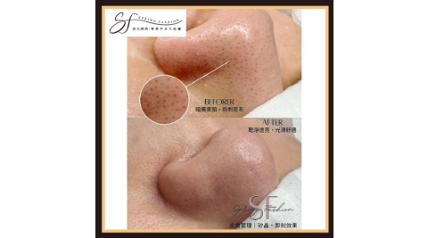 台北大安區【春天時尚】德卡護膚保濕導入保養NT$2,000乙堂優惠券